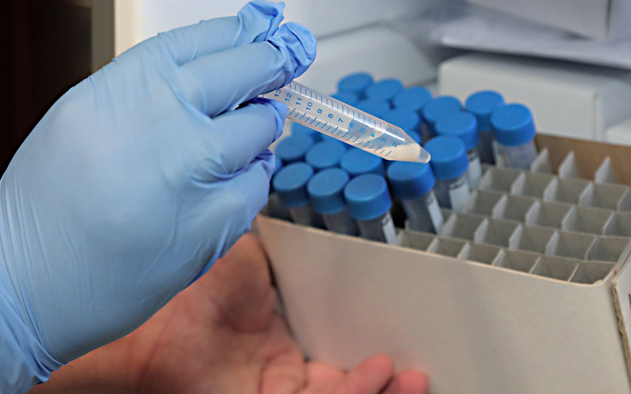 24 Neuinfektionen, aktuell 244 infizierte Krefelder