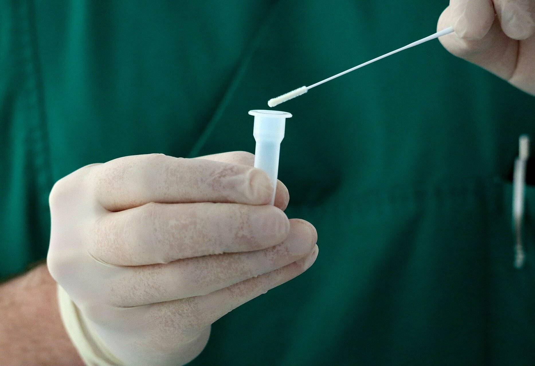 Maaßen fordert Unterstützung für Schnelltests zum Unterrichtsbeginn.  