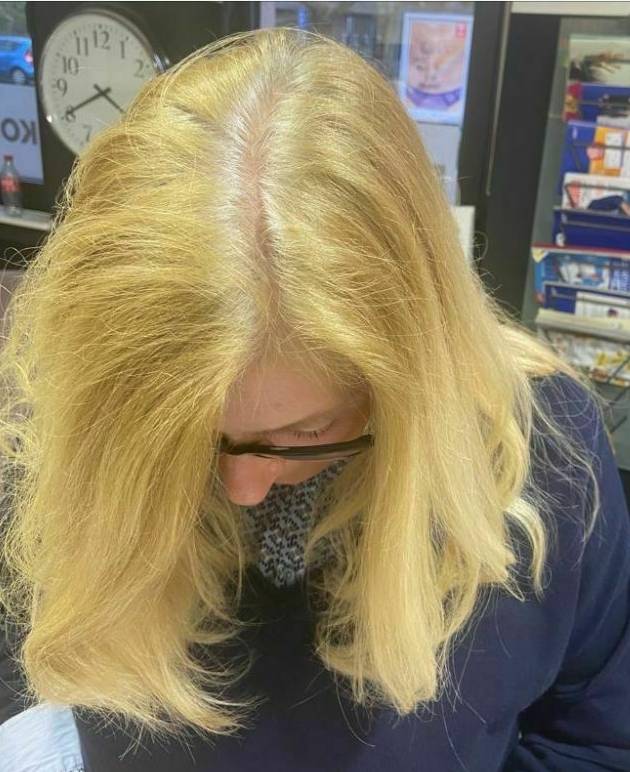 Rückpigmentierung vorher.