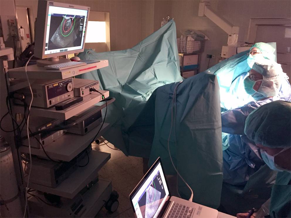 In der vergangenen Woche wurde die erste Patentin durch die neue Sonata-Minimalinvasive Radiofrequenzbehandlung von einem Gebärmuttermyom befreit.