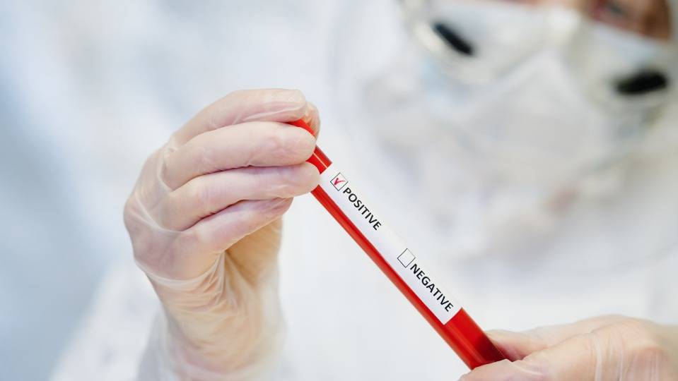 Kostenlose Corona-Tests fürs Personal