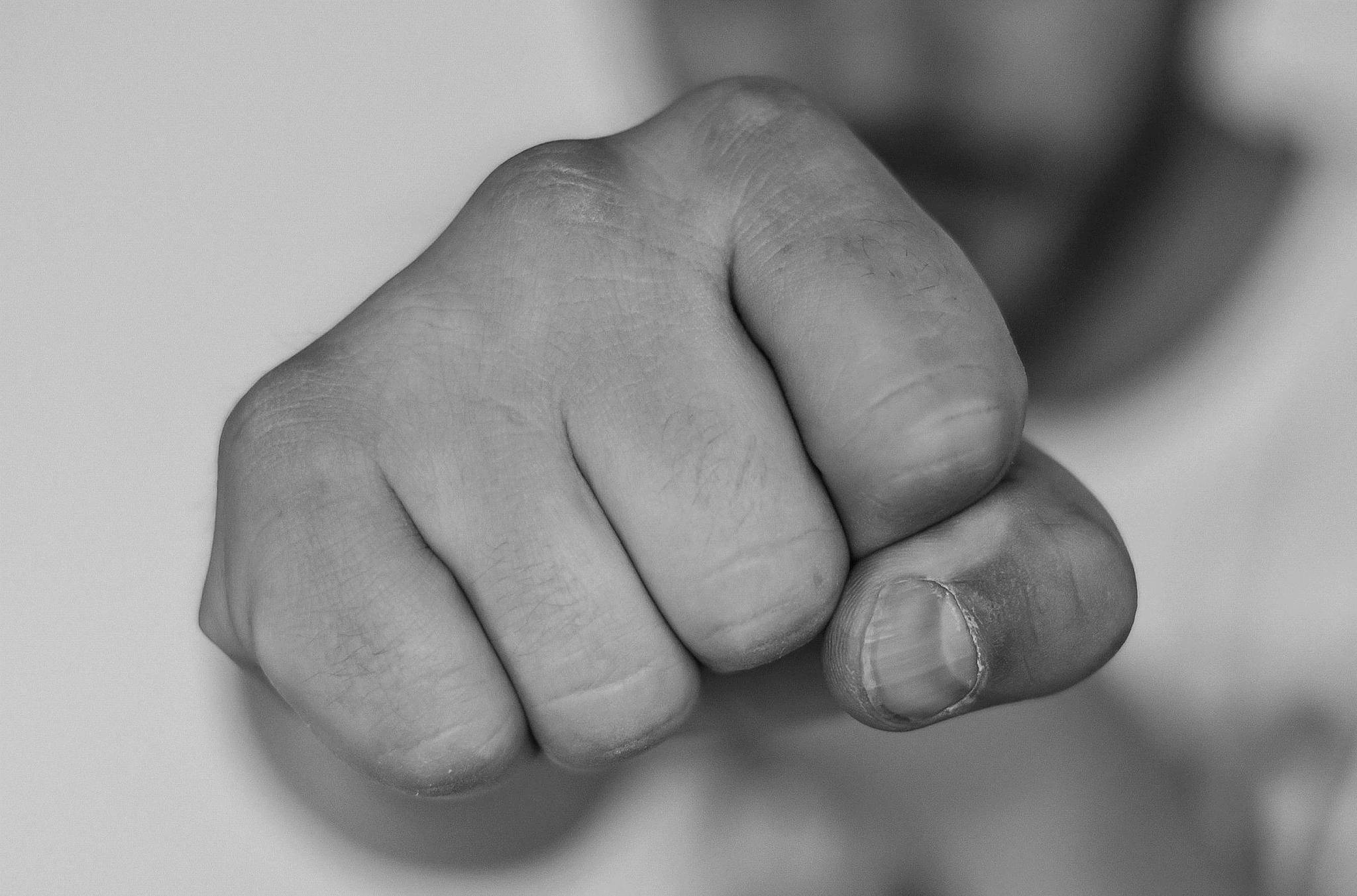 Polizei fragt: Wer hat etwas gesehen?: Unbekannter lockt Mann zur Kempener Alle und schlägt auf ihn ein