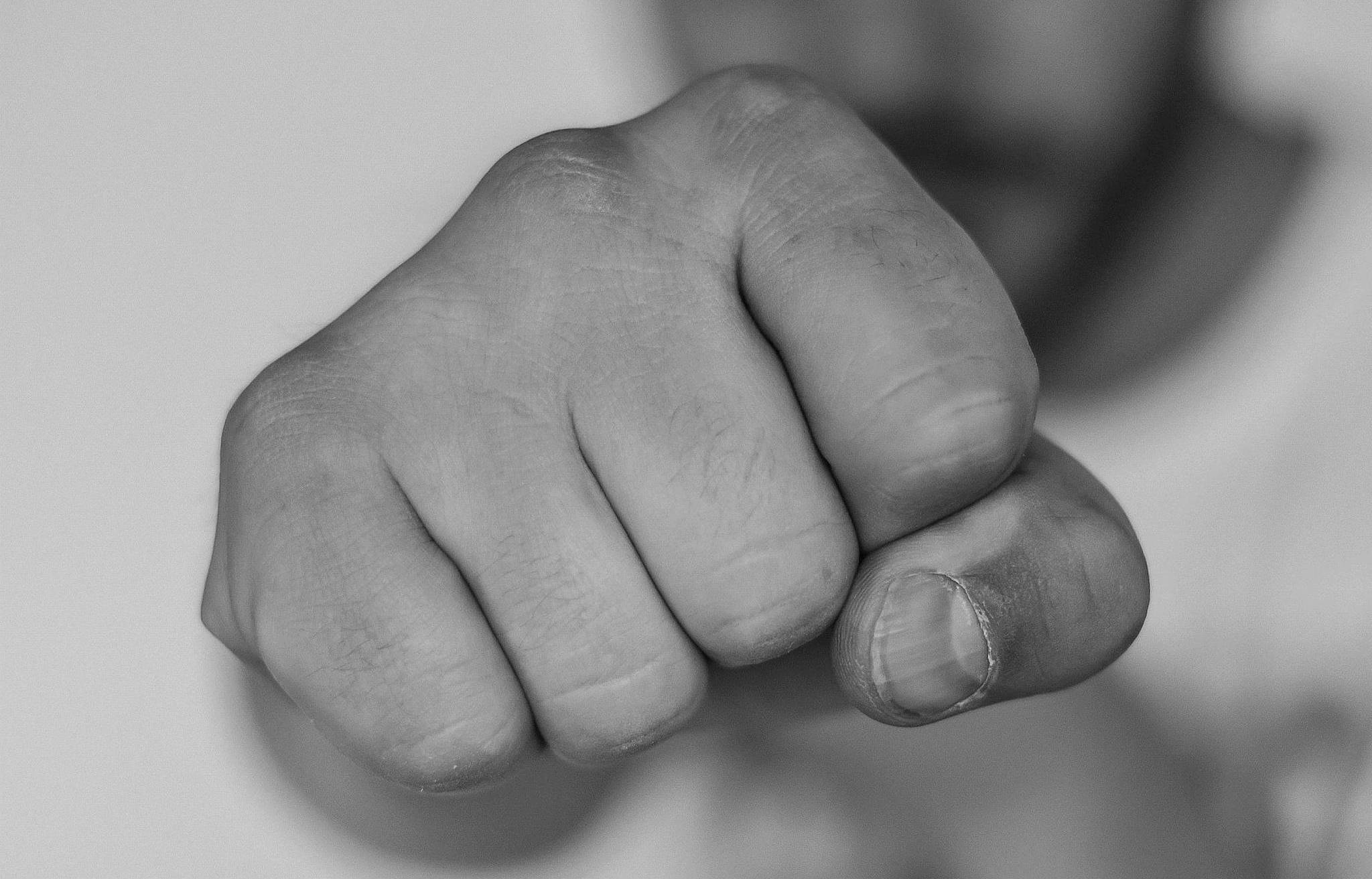 Unbekannter lockt Mann zur Kempener Alle und schlägt auf ihn ein